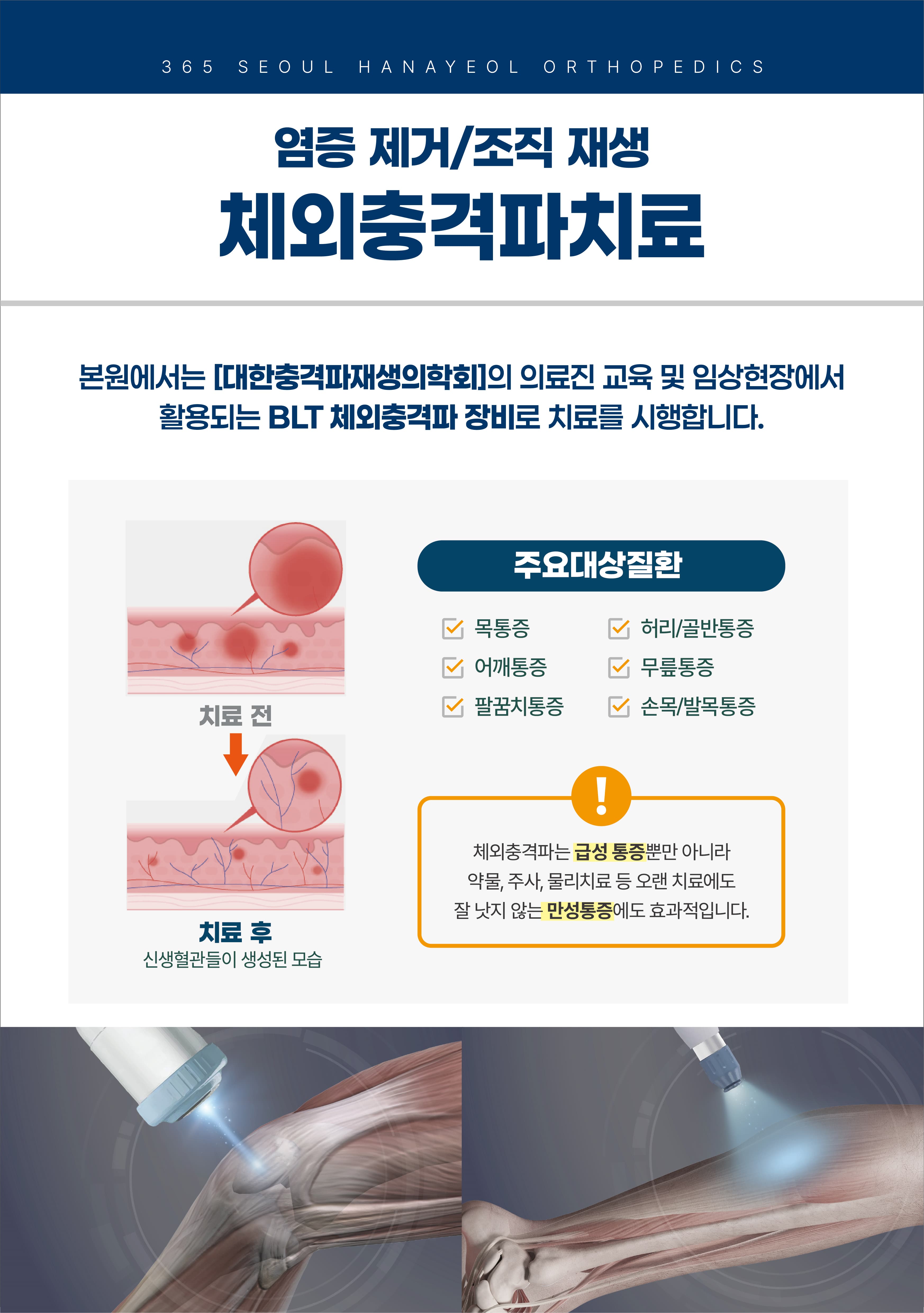 체외충격파 치료 전후 신생혈관 생성과 주요 대상 질환 안내