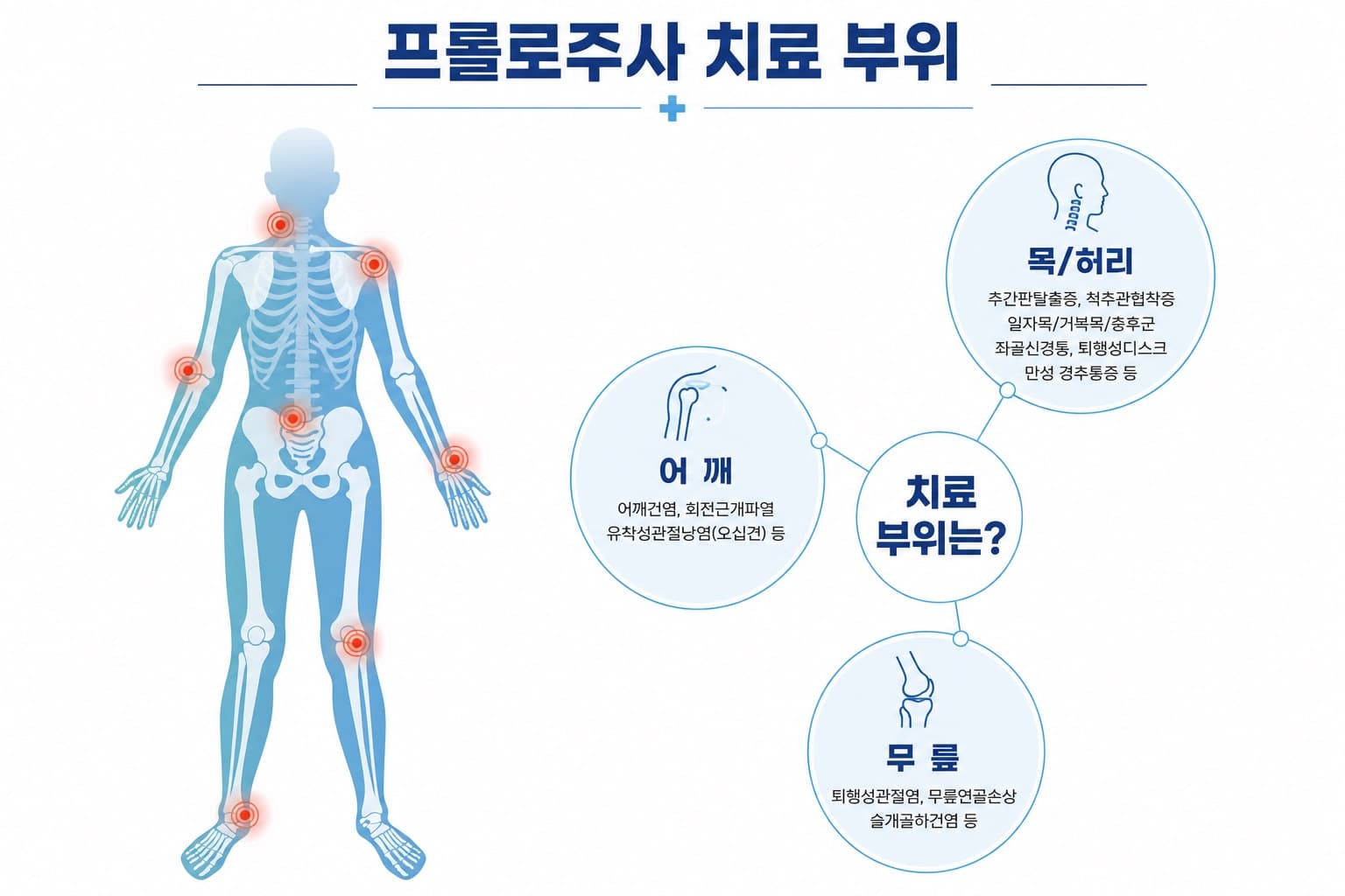 프롤로주사 치료 안내 이미지