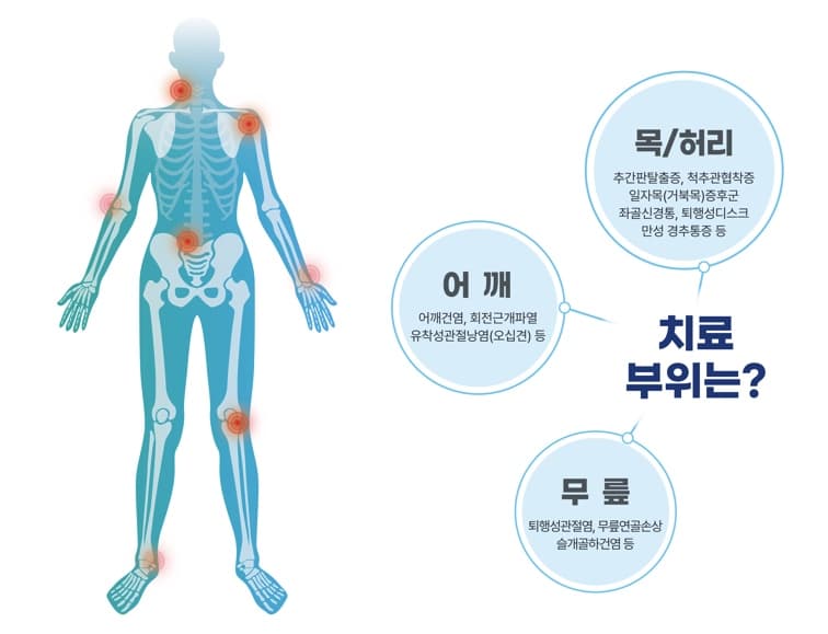프롤로주사 치료 안내 이미지