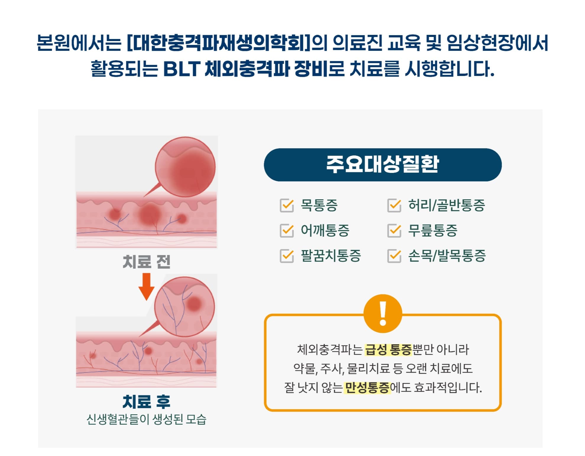 체외충격파 치료 적용 부위와 효과 안내