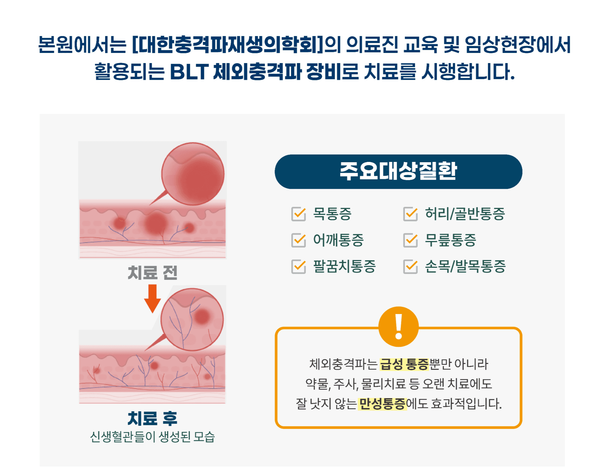 체외충격파 치료 적용 부위와 효과 안내