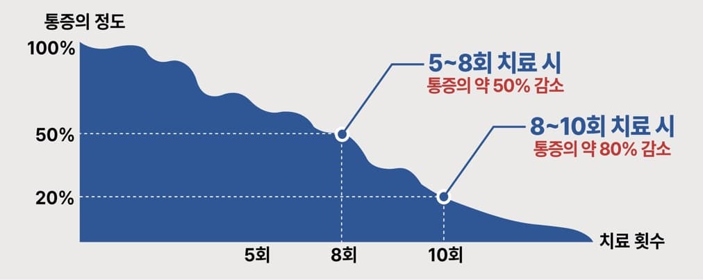 체외충격파 치료 장비 안내