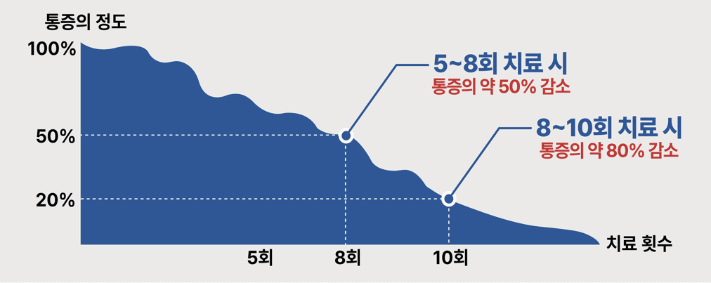 체외충격파 치료 장비 안내