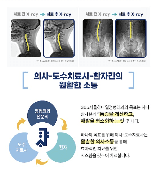 도수재활치료 전후 X-ray와 의사, 도수치료사, 환자 간 소통 안내
